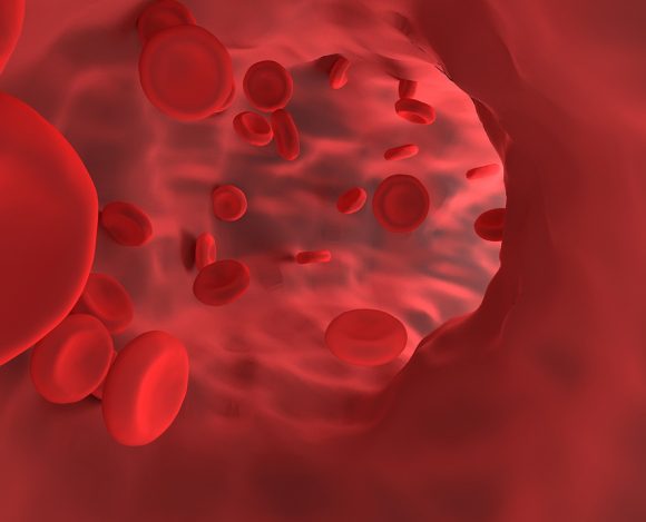 Dari Perisai ke Pedang: DNA Damage Response Untuk Terapi AML